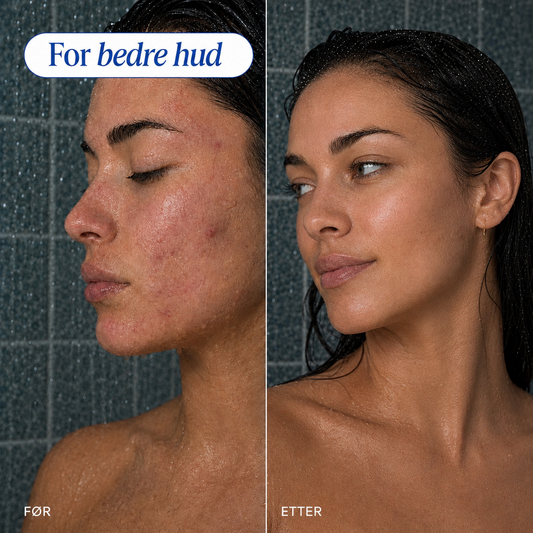 Roligere hud og mindre frizz innen 30 dager med Aqualéa filtrerende dusjhode.
